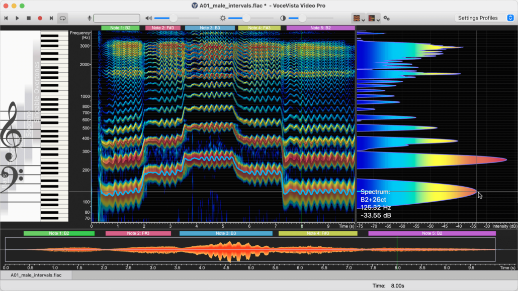 Screenshot of VoceVista Video 5.8.0